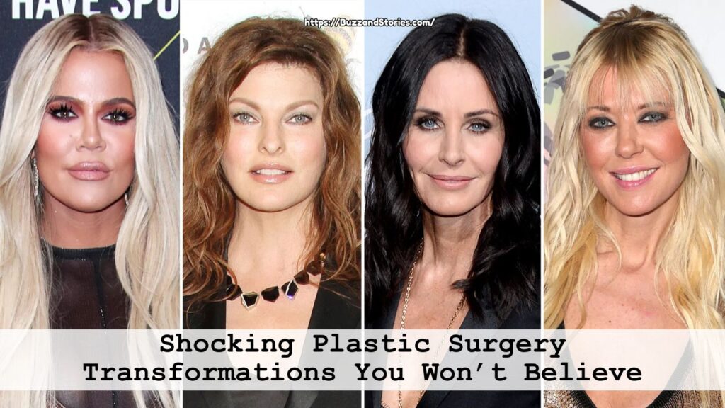 Shocking Plastic Surgery Transformations You Won’t Believe