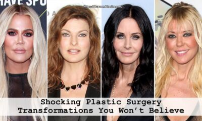 Shocking Plastic Surgery Transformations You Won’t Believe