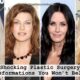 Shocking Plastic Surgery Transformations You Won’t Believe