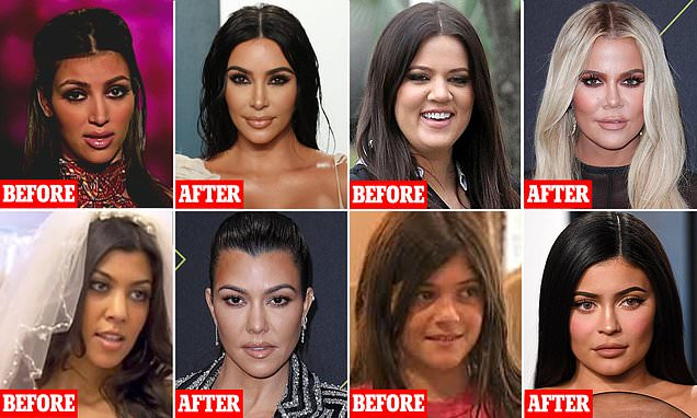 A before-and-after image collage featuring several people who have undergone extreme plastic surgeries, showcasing the dramatic transformations in their appearance.