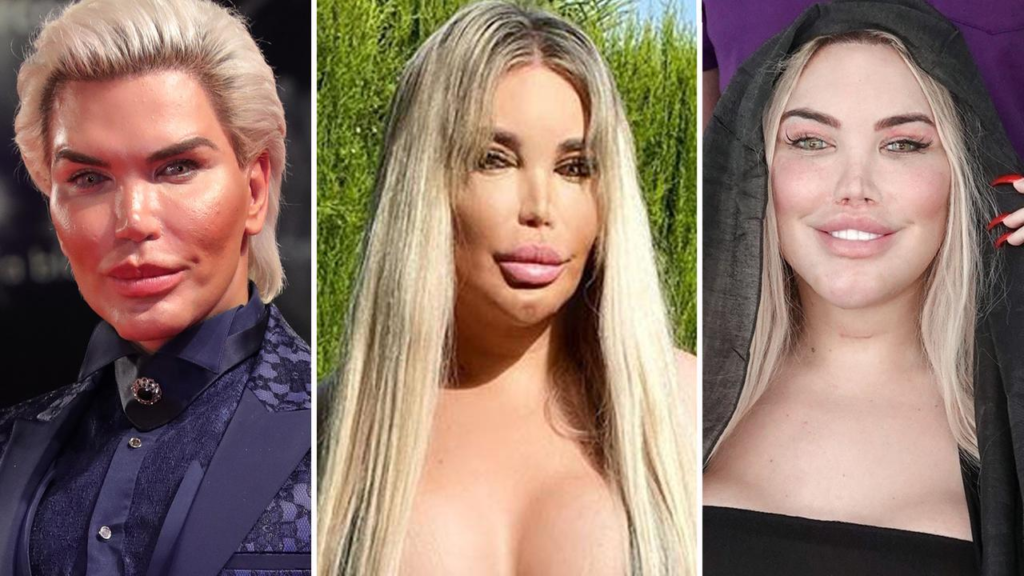 A collage of different men who have undergone plastic surgery to look like Ken, showing their dramatic transformations.