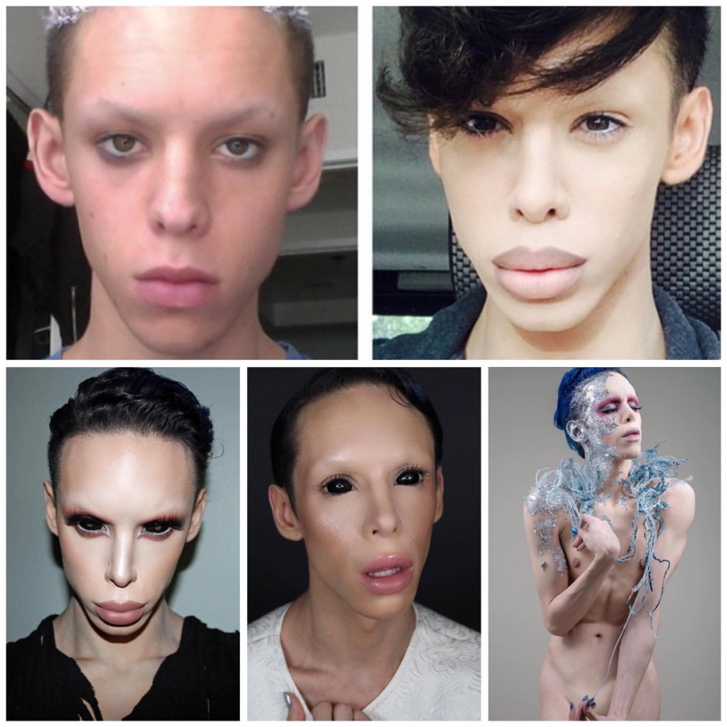 A before-and-after image of Vinny Ohh, showcasing the extreme surgeries that have transformed him into an androgynous alien figure.