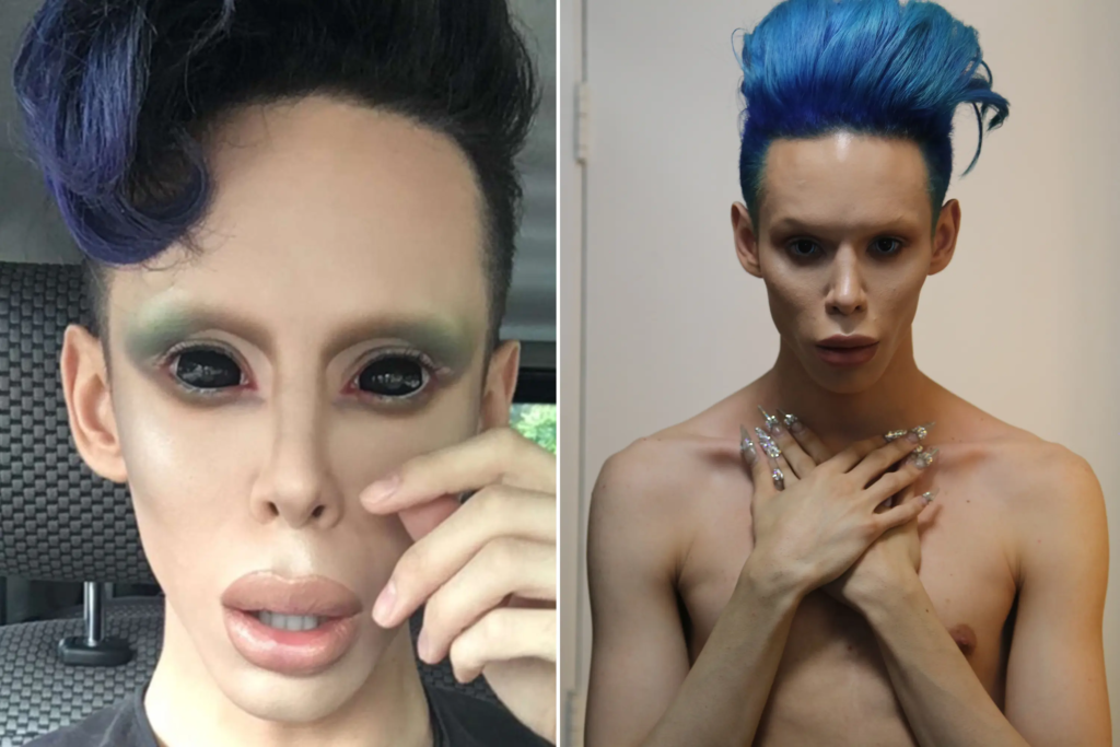 A before-and-after image of Vinny Ohh, showcasing the extreme surgeries that have transformed him into an androgynous alien figure.