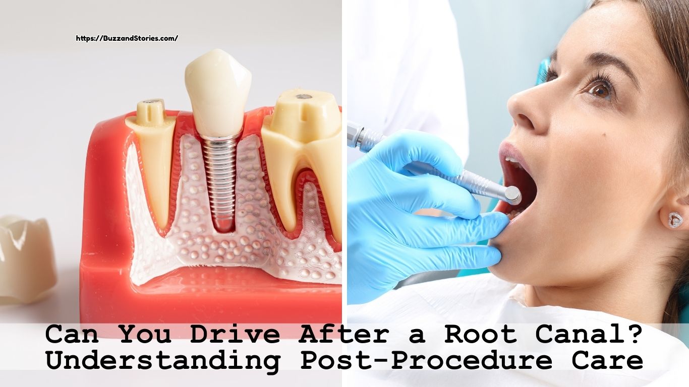 Can You Drive After a Root Canal Understanding Post-Procedure Care