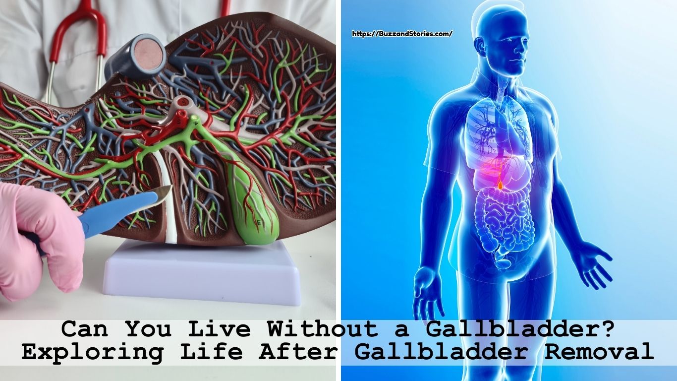 Can You Live Without a Gallbladder? Exploring Life After Gallbladder Removal