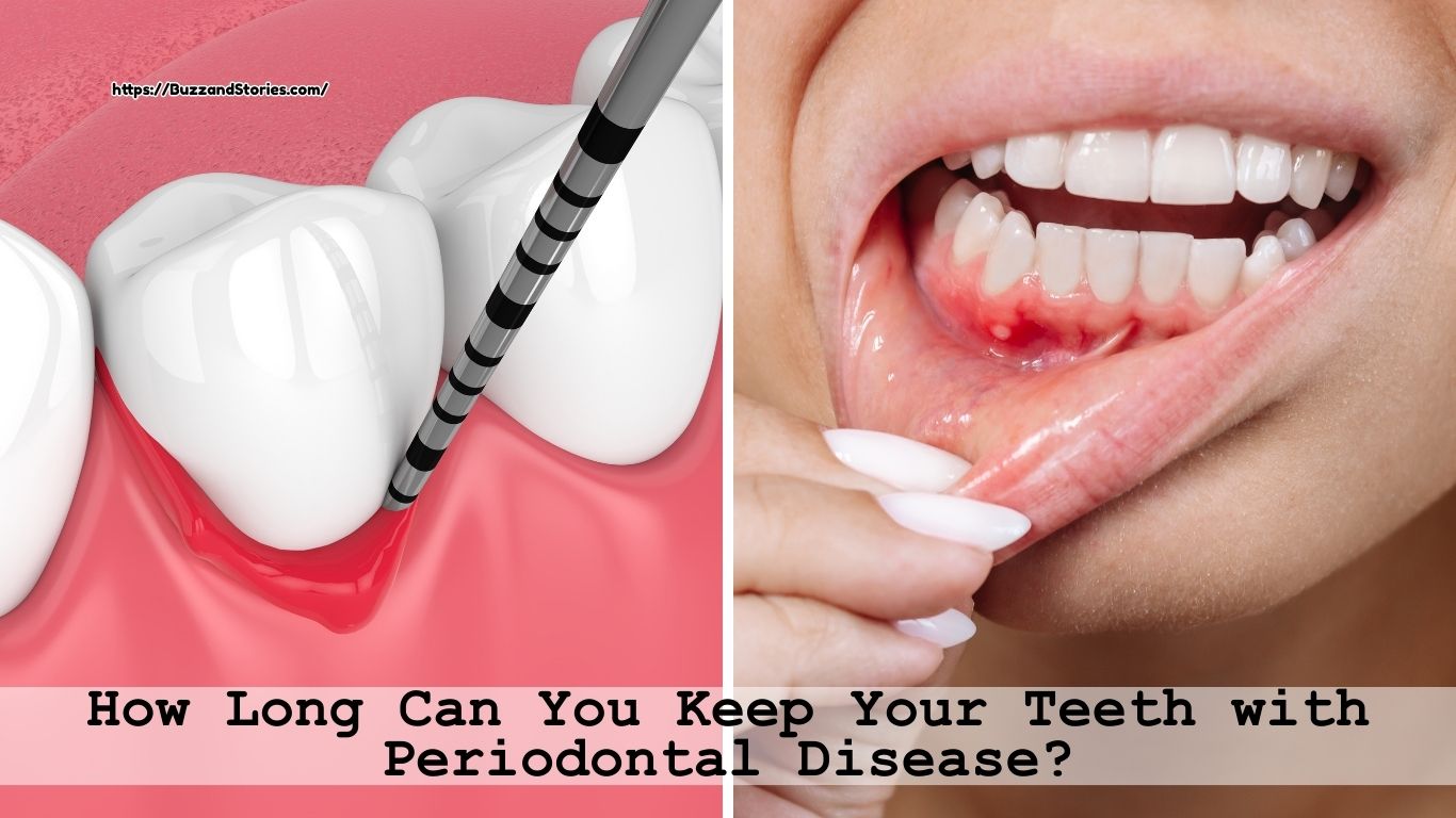 How Long Can You Keep Your Teeth with Periodontal Disease