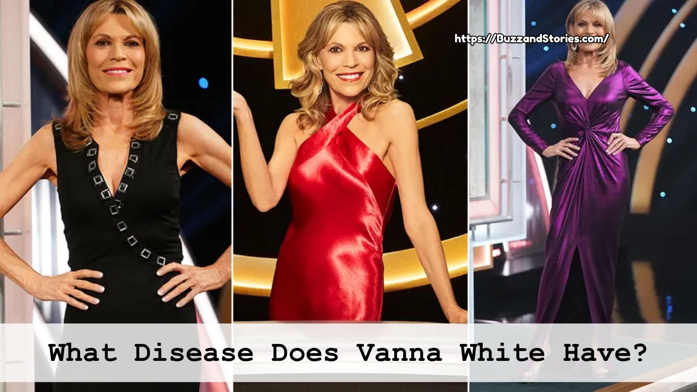 What Disease Does Vanna White Have